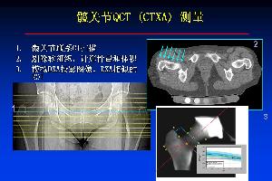 髋关节QCT骨密度测量